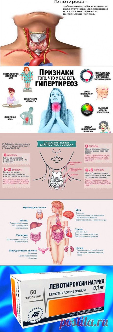 Гипотиреоз: причины, симптомы и лечение в статье О. Гуровой