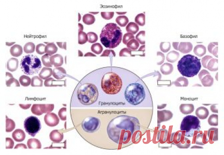 Лейкоцитоз. Почему повышены лейкоциты в крови, норма содержания. Что такое лейкоциты на Medside.ru