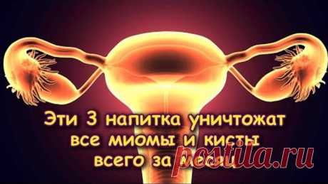 Эти 3 НАПИТКА уничтожат все МИОМЫ и КИСТЫ всего за месяц