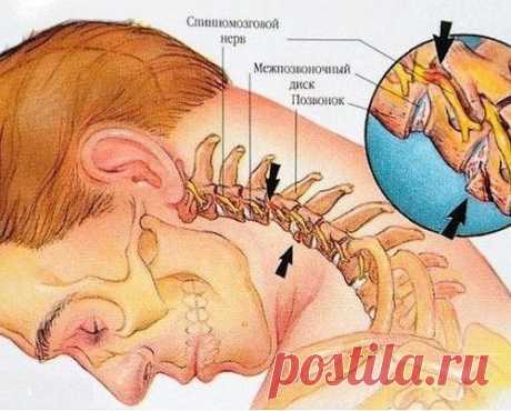 Восемь упражнений против шейного остеохондроза