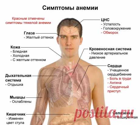 нехватка меланина в организме симптомы и лечение: 2 тыс изображений найдено в Яндекс.Картинках