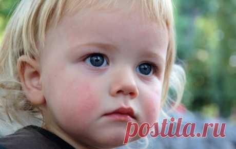 Диатез на щеках у ребенка: лечение