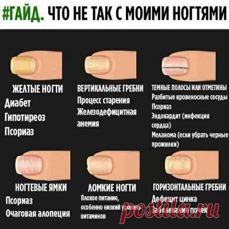 Что не так с ногтями