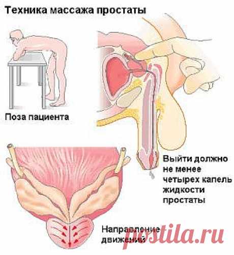 Простата_Массаж | Рецепты народной медицины