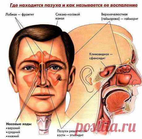 Лечим насморк дома..