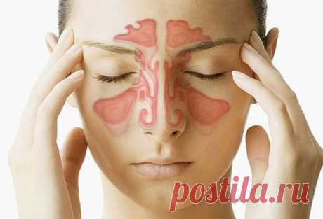 Как быстро избавиться от заложенности носа Заложенный нос может быть вызван вирусом, передающимся воздушно-капельным путем. При поглощении носом организм выделяет химическое вещество гистамин, который увеличивает приток крови к носу и вызывает отек носовой ткани.