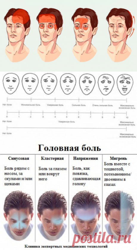 Самый полный гид по головной боли