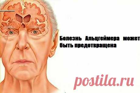 Болезнь Альцгеймера может быть предотвращена: только одно упражнение в день и ваша память станет намного лучше 


Практический метод профилактики болезни Альцгеймера







 


Альцгеймер является одним из самых распространенных дегенеративных заболеваний во всем мире, как правило, затрагивает очень старых люд…