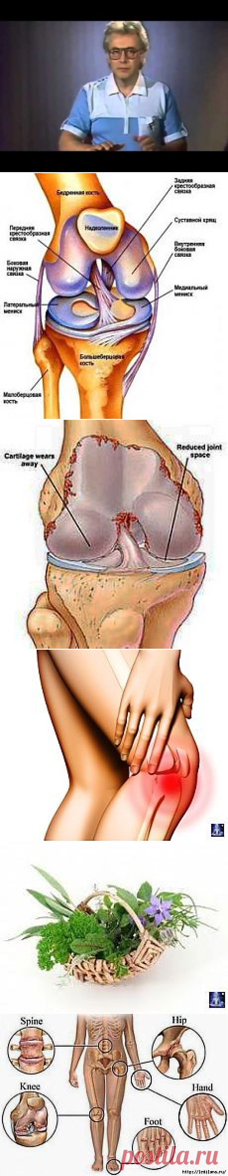 СУСТАВЫ | Фотографии и советы на Постиле