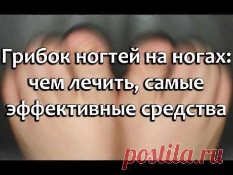 Грибок ногтей на ногах, чем лечить, секреты и хитрости