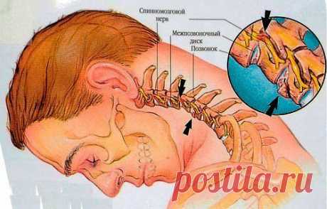 Если у вас болит шея.