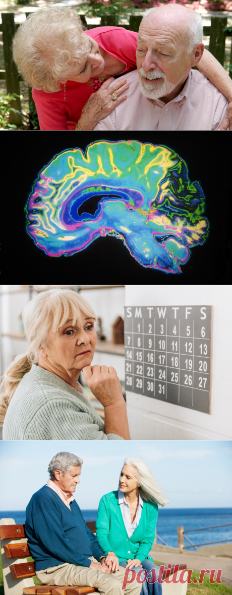 Как распознать болезнь Альцгеймера и что с ней делать? | Красота и здоровье