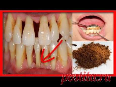СТОМАТОЛОГИ СКРЫВАЮТ , что вылечить парадонтоз и убрать зубной камень можно простым порошком