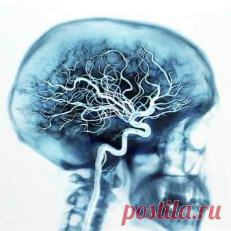 Как почистить сосуды головного мозга народными средствами С возрастом на стенке сосудов оседают вредные вещества. Подобные процессы приводят к сужению просвета и ухудшению кровоснабжения