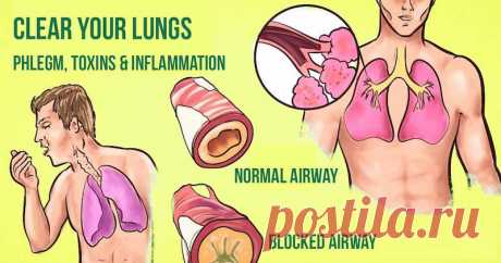 Простые способы избавиться от надоедливой мокроты в лёгких и горле (Мгновенный РЕЗУЛЬТАТ) - Журнал для женщин Зима на подходе, а вместе с ней простуды, грипп и назойливые вирусы. Кроме того, если у вас есть маленькие дети, практически невозможно остаться здоровым. Отёк и воспалительные заболевания дыхательных путей могут провоцировать кашель и затруднённое дыханием в следствии скопления мокроты. Мокрота секретируется органами дыхания, как инструмент для выведения бактерий ...