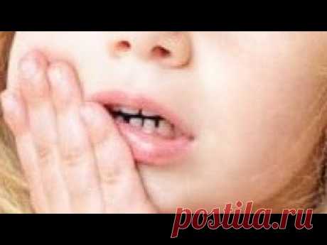 ПОРТЯТСЯ ЗУБЫ у ребёнка. Чем укрепить детские зубы?