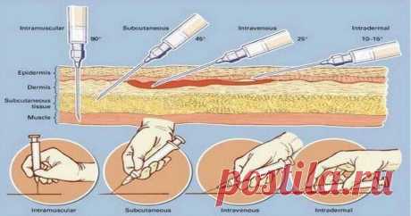Как правильно делать инъекции? Сохраните себе чтобы знать! Внутримышечную инъекцию рекомендуется делать в наиболее крупные мышцы