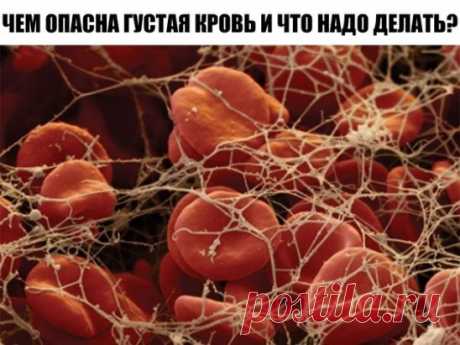 ЧЕМ ОПАСНА ГУСТАЯ КРОВЬ И ЧТО НАДО ДЕЛАТЬ?
Некоторые знают, что густую кровь надо разжижать. Замедленный кровоток приводит к кислородному голоданию внутренних органов. И к возможному образованию тромбов.
Итак, что нужно делать, чтобы кровь свободно циркулировала. Несколько простых советов.
Профилактика образования тромбов
1. Пейте больше воды! 90% людей пьют очень мало воды. Речь именно о кипяченой природной воде, а не о жидкостях. Взрослый человек должен выпивать ежедневно 2-2,5 литра воды.