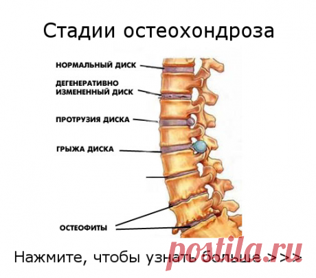 стоимость эмт грудных позвонков: 10 тыс изображений найдено в Яндекс.Картинках