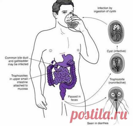 Как избавиться от лямблий — 25 эффективных рецептов народной медицины