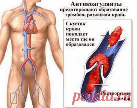 Народные средства, разжижающие кровь