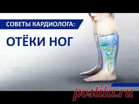Советы кардиолога Сергиенко: Отёки ног