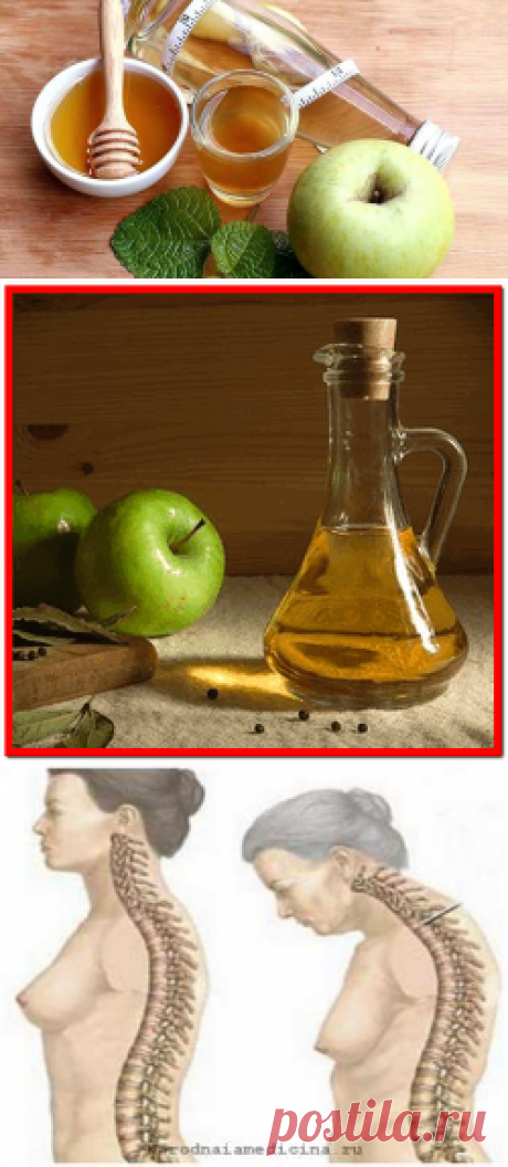 Яблочный уксус: польза и вред, применение в народ. медицине
