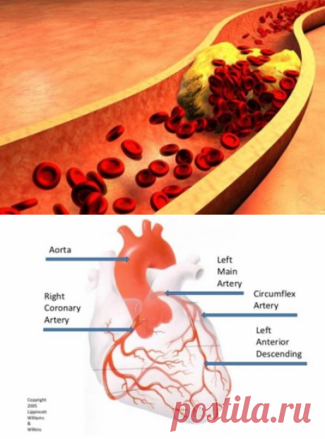 Что нужно знать о давлении
Давление – это определение того, с какой силой на стенки кровеносных сосудов воздействует кровь. Повышенное давление приводит к патологиям сердца (из-за огромной нагрузки на сердечные мышцы); вредит сосудам: кровь сильнее давит на стенки, те разрушаются, в трещинах скапливается холестерин, начинается воспаление, образуется «бляшка», которая в дальнейшем превращается в тромб. Если он формируется в сосудах сердца — инфаркт миокарда. Если направляет...