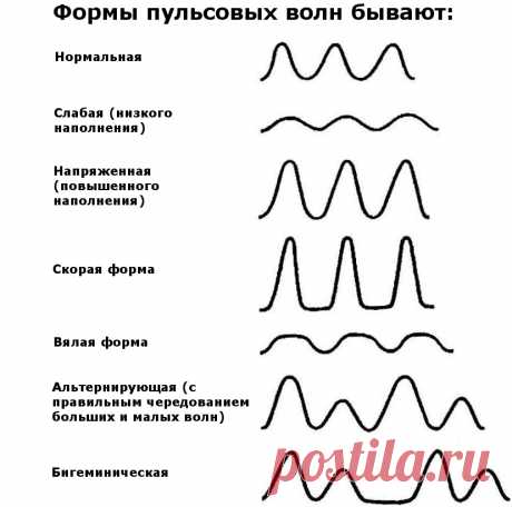 Нормальный пульс человека по годам, возрастам: таблица. Пульс — норма по возрастам у женщин, мужчин, детей: таблица. Какая норма пульса у взрослого человека в покое, физических нагрузках, у беременных? Где можно прощупать и измерить пульс?