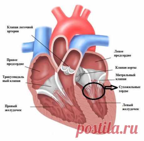 Дополнительная хорда в сердце - Причины, симптомы и лечение. МЖ