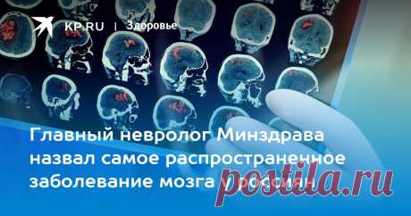 23-7-22-Главный невролог Минздрава назвал самое распространенное заболевание мозга у россиян Также эксперт рассказал, как влияет на центральную нервную систему перенесенный ковид