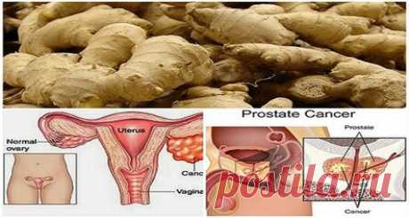 Исследованием доказано, что имбирь может исцелить рак предстательной железы, рак яичников и рак толстой кишки гораздо лучше, чем химия!