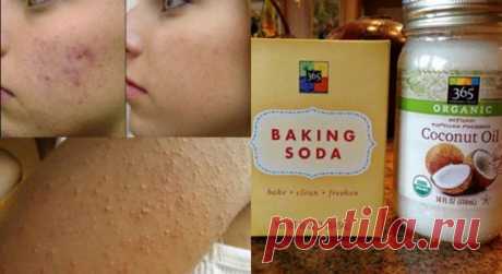 This Is How To Use Coconut Oil And Baking Soda To Look 10 Years Younger