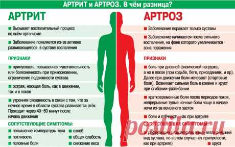 Чем отличается артрит от артроза различия по симптомам Все о болезнях и болях в суставах и их лечении