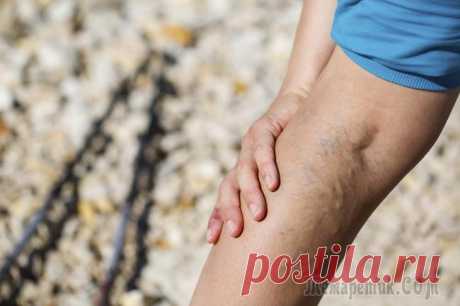 Лучшие методы лечения варикозного расширения вен на ногах