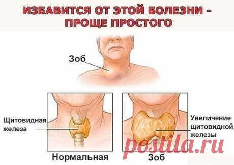 Проще простого: йод, хвойный отвар и лавровый лист.