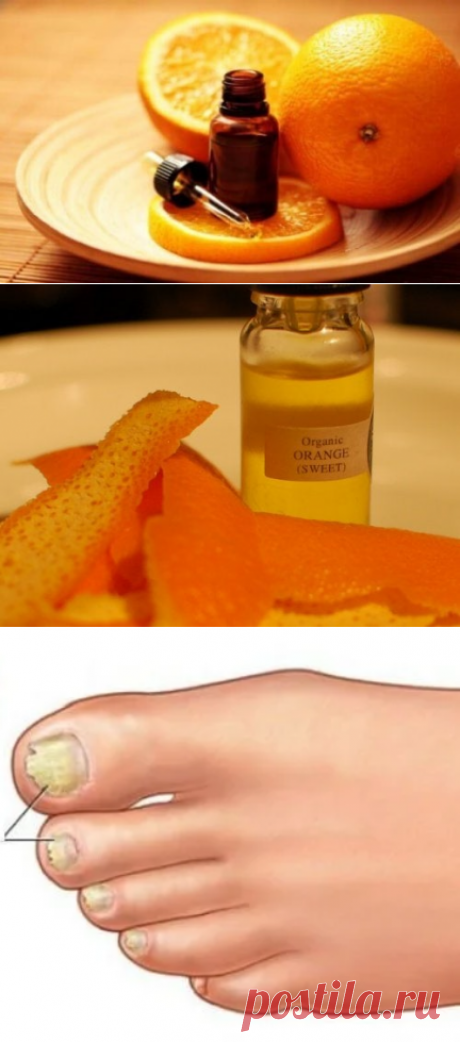 Масло апельсина от грибка ногтей