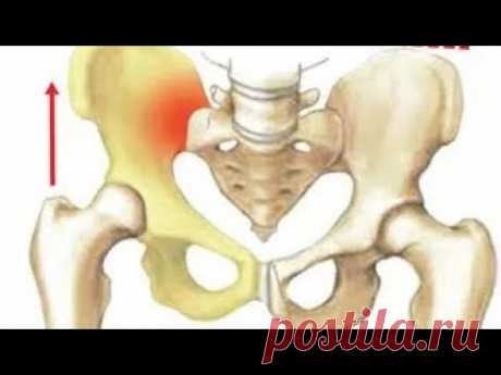 Упражнения для стабилизации крестцово-подвздошного сустава. Малиновская