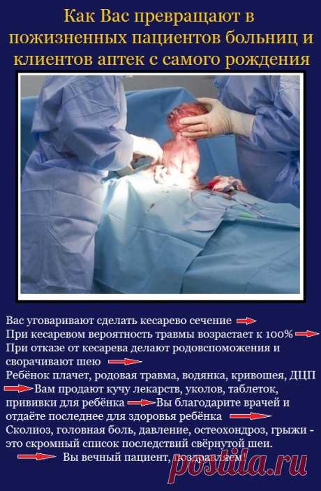 ✔ КАК ВАС ПРЕВРАЩАЮТ В ПОЖИЗНЕННЫХ ПАЦИЕНТОВ И КЛИЕНТОВ АПТЕК С САМОГО РОЖДЕНИЯ ⁉

➡ Вас уговаривают сделать #кесарево #сечение 
➡ При кесаревом вероятность травмы ребёнка возрастает к 100% 
➡ При отказе от кесарева делают #родовспоможения и сворачивают шею 
➡ #Ребёнок плачет, родовая травма, #водянка, #кривошея, #ДЦП 
➡ Вам продают кучу #лекарств, уколов, #таблеток, #прививки для ребёнка 
➡ Вы благодарите врачей и отдаёте последнее для здоровья ребёнка