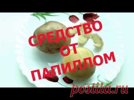 (5929) ВИСЯЧИЕ ПАПИЛЛОМЫ ??? - БЫСТРОЕ ИЗБАВЛЕНИЕ БЕЗ СЛЕДА!!! - YouTube