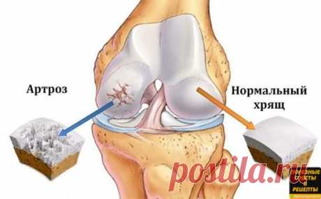 Это скрывали все хирурги! Так лечатся суставы дома за сутки