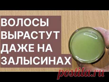 Волосы Вырастут Даже на Залысинах! Сильное Средство! Рецепт