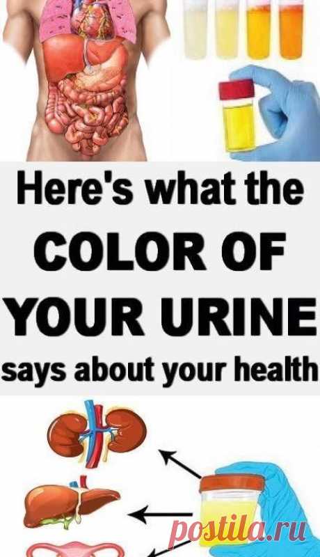 WHAT THE COLOR OF YOUR URINE SAYS ABOUT YOUR HEALTH!!!