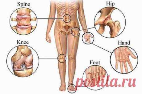 Отличный рецепт от боли в суставах