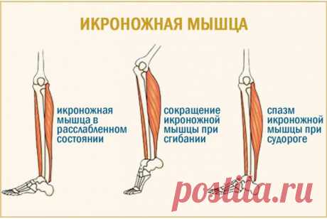 Cудороги мышц ног и бедра ночью и днем причины и лечение фото Все о болезнях и болях в суставах и их лечении