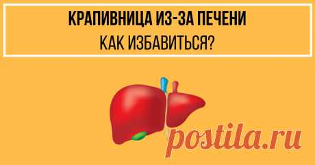 Крапивница из-за печени. Как избавиться?
#здоровье #семья #диета #красота #медицина #зож #правильное #питание #здоровое #правильноепитание #пищеварение #кишечник #желудок #вздутие #СРК #детокс #детоксикация #лайфхак #центрсоколинского #аюрведа #иммунитет #очищение #детокспрограмма