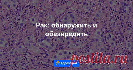 Все о раке Рассказываем, как предотвратить онкологическое заболевание, и что делать, если диагноз все же поставили