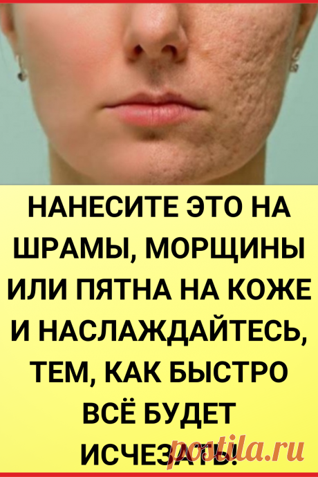 Нанесите это на шрамы, морщины или пятна на коже и наслаждайтесь, тем как быстро все будет исчезать!