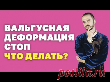 Упражнения при вальгусной деформации стоп! Что делать? Гимнастика Цигун! Деформация стоп.