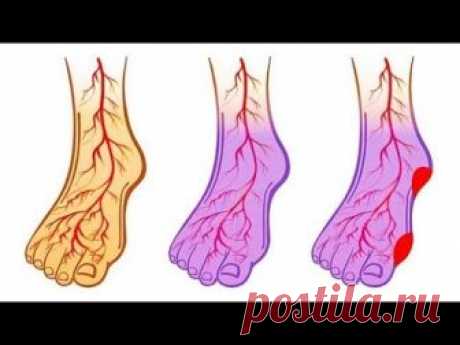 Если у Вас Высокое Давление Или Варикоз, Начните Делать Это - ЛЕНТЯЙКИ.РУЛЕНТЯЙКИ.РУ